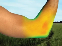 BACK ON TRACK BOT LL Braces|Back on Track® Elbow Brace